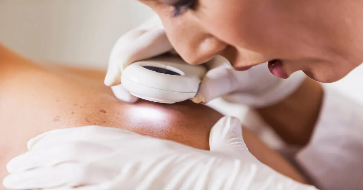 Dermatologia: cuidados essenciais com a pele no Maranhão